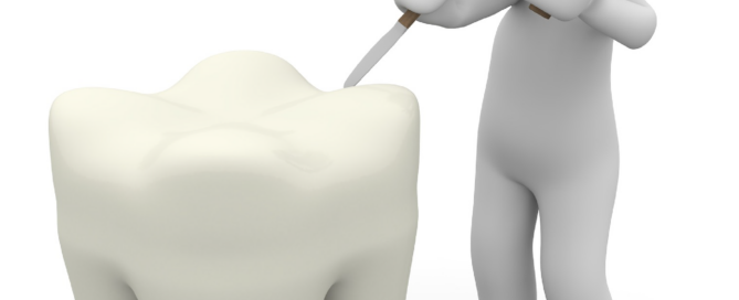 Ein Fantasiemännchen steht mit Hammer und Meißel an einem großen Zahn.