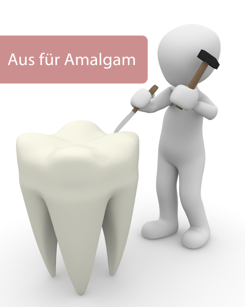 Aus für Amalgam – Neuregelung bei Zahnfüllungen